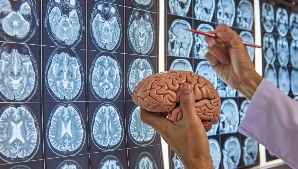 22 de julio Día Mundial del Cerebro
