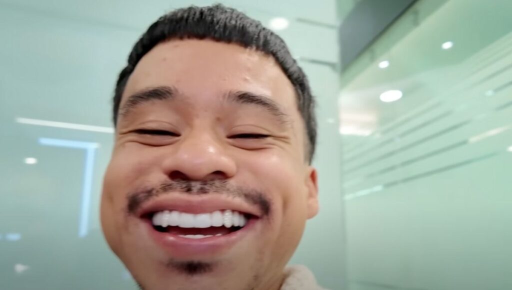 abelito confiesa que tiene diamantes en los dientes