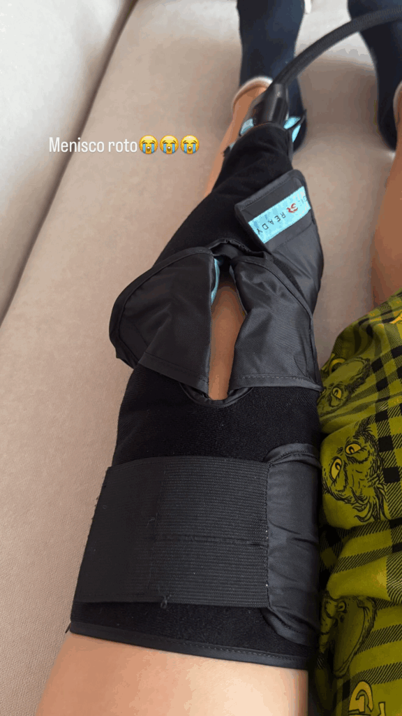 Belinda lesión en rodilla Mentiras el musical