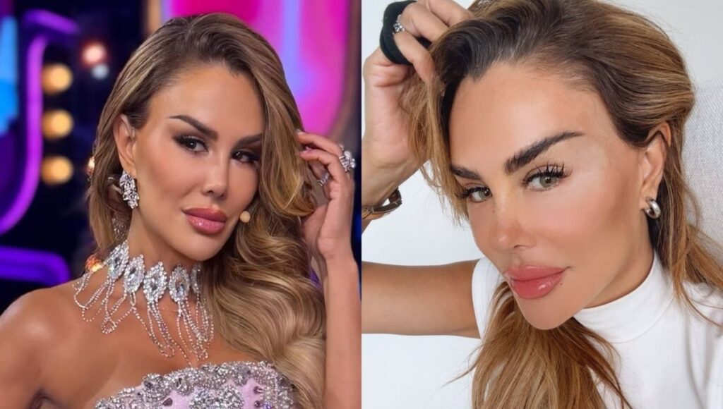 Ninel Conde se somete a cirugía de cambio de color de sus ojos