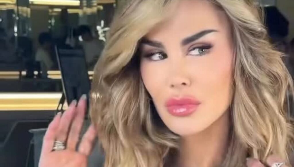 Ninel Conde se somete a cirugía de cambio de color de sus ojos