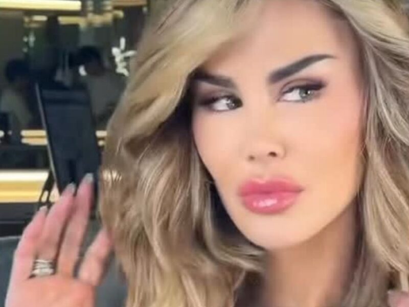 Ninel Conde se somete a cirugía de cambio de color de sus ojos