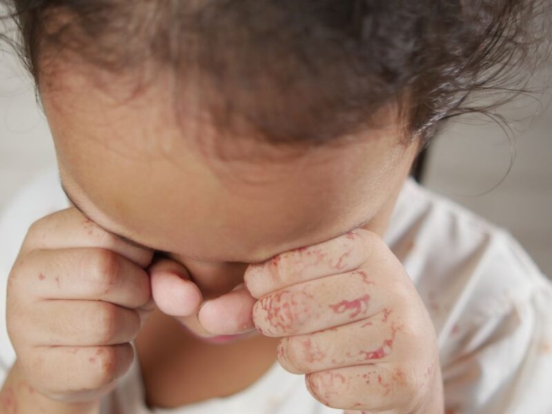 Día Mundial para Prevenir la Explotación, los Abusos y la Violencia Sexuales contra los Niños y Promover la Sanación