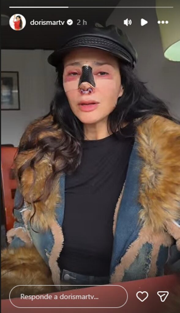 Dorismar cirugía estética fallida