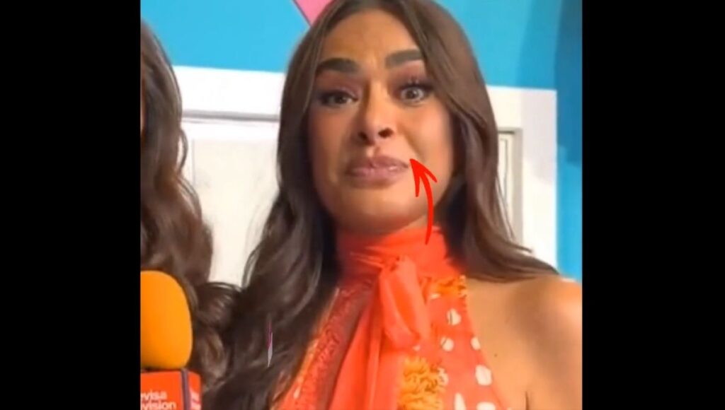Galilea Montijo público se preocupa por su ojo