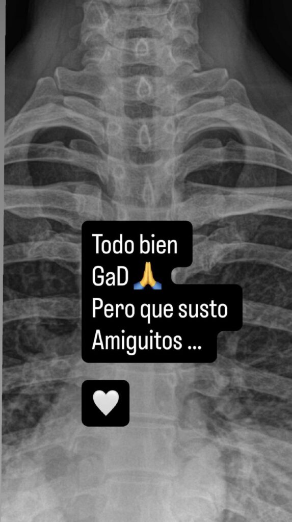 Anahí sufre fuerte caída mientras se ejercitaba